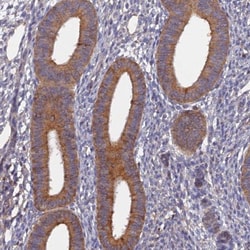 SLC38A11 Antibody, Novus Biologicals 25 &mu;L; Unlabeled:Antibodies, Polyclonal